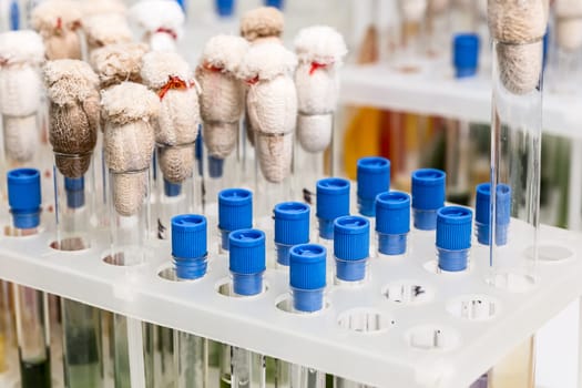 Test tubes arranged on medical trolley. Medical research