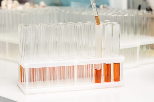 Test-tubes with yellow liquid in the laboratory. Medical research