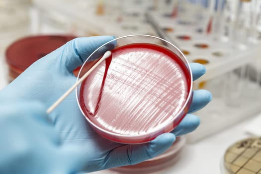 lab technician hand planting a petri dish. Laboratory, research, analysis. Close-up