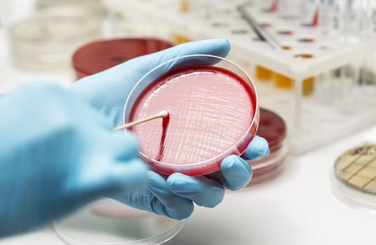 lab technician hand planting a petri dish. Laboratory, research, analysis. Close-up