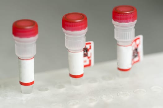 Test tubes arranged on medical trolley. Medical research