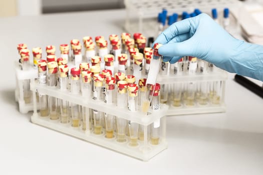 A chemical sample bottle. Centrifuge. A test tube vial sets for analysis. Medical research