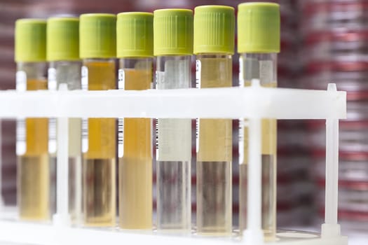 Test-tubes with yellow liquid in the laboratory. Medical research