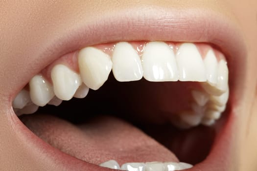 Closeup Dental Beauty. Beautiful Macro Photo of Smile with perfect White Teeth. Sexy Fashion Lips with Natural Make-up. Whitening Tooth and Wellness Treatment