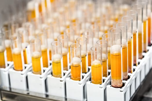 Test-tubes with yellow liquid in the laboratory. Medical research