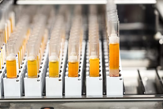 Test-tubes with yellow liquid in the laboratory. Medical research