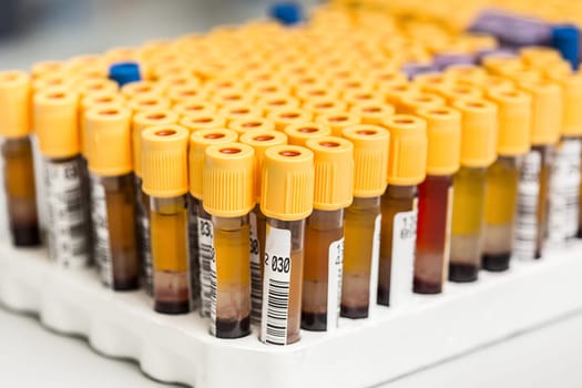 Test-tubes with yellow liquid in the laboratory. Medical research