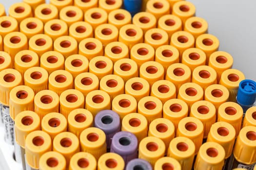 set of Test tubes in the laboratory