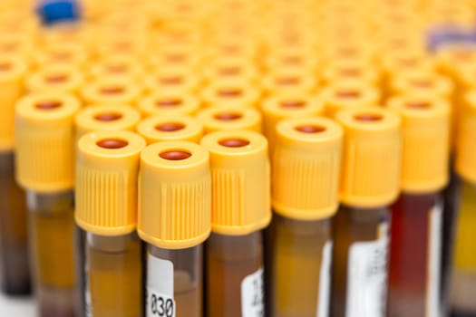 set of Test tubes in the laboratory