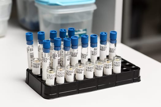 Test tubes arranged on medical trolley. Medical research