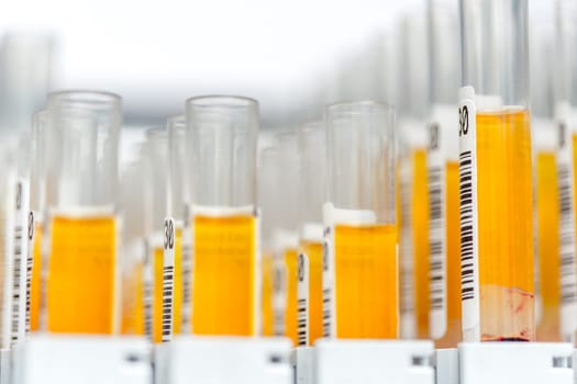 Laboratory glass test tubes filled with orange liquid for an experiment in a science research lab. Analyzes