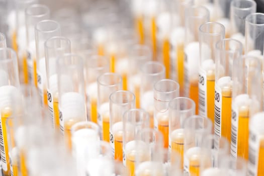 Laboratory glass test tubes filled with orange liquid for an experiment in a science research lab. Analyzes