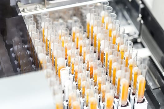 Test-tubes with yellow liquid in the laboratory. Medical research