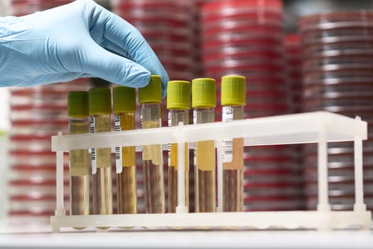 Test-tubes with yellow liquid in the laboratory. Medical research