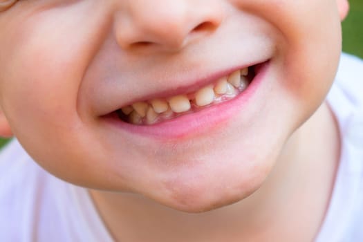 Cheerful child, 2-year-old boy laughing, close-up of part of the child's face, children's mouth, concept of sensory feelings, sincere emotions, speech disorders, development exercises.