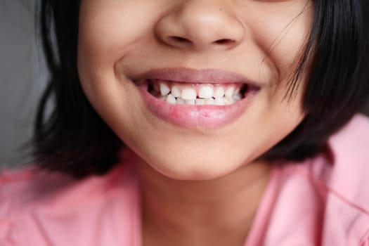 child smiling with healthy white teeth