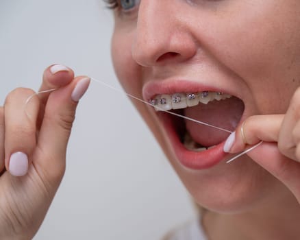 Caucasian woman cleaning her teeth with braces using dental floss. Cropped portrait