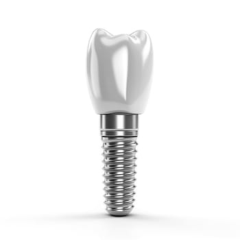 3D illustration of tooth implant on white background, dental concept