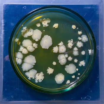 Colonies of pathogenic bacteria in a Petri dish, microbiological studies