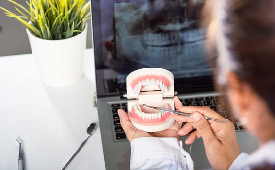 Oral dental hygiene. Dentist female holding professional stomatology tool and pointing healthy tooth model and explaining patient at clinic office and teeth X-ray on laptop screen, dental healthcare