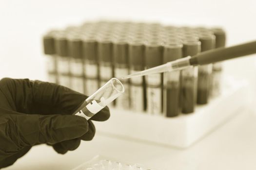 hands of a lab technician with a tube of blood sample and rack with other samples. lab technician holding blood tube sample for study