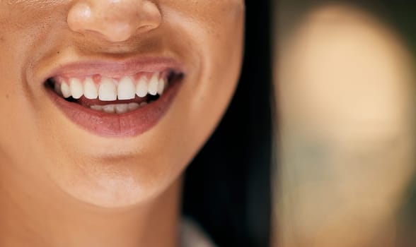 Smile, mouth and face macro of woman inside for happiness, beauty and wellness for friendly dentist. Healthcare, dental care and zoom of happy girl with big smile, healthy teeth and natural skin.