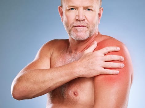 Sunburn, skincare and portrait of a man with red skin color and burn texture in studio. Isolated, blue background and male model looking for wellness, health and soothing solution for body problem.