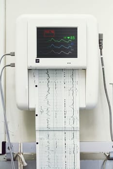 Close up of a fetal monitor or non stress test printing baby heartbeats, electrocardiograph and mother uterine contraction in Labor and delivery room at hospital.