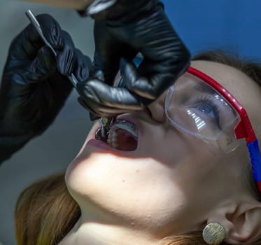 The process of removing braces. A beautiful woman in protective glasses in a dental chair during the procedure of removing braces from teeth. Dentist and assistant working.