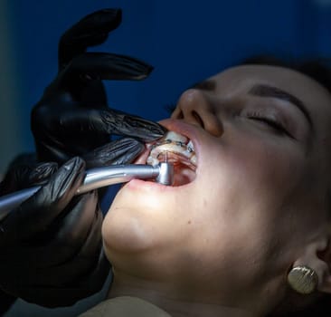 The process of removing braces.Beautiful woman in dental chair during procedure of installing braces to upper and lower teeth. Dentist and assistant working together, dental tools in their hands.