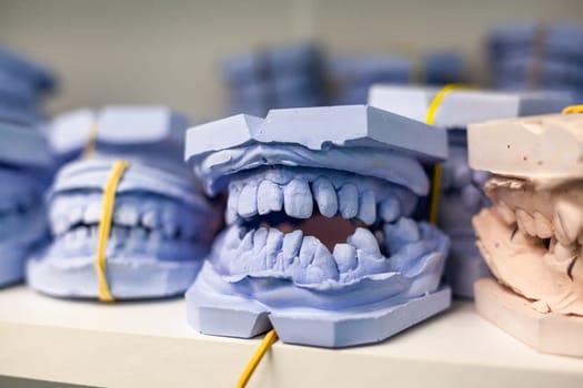 Dental gypsum models cast of a human dental jaw. Gypsum models lie on a shelf in a row. Laboratory prosthetics. Close-up shot. Shelf with lying on her casts of teeth and prosthetic and restorations