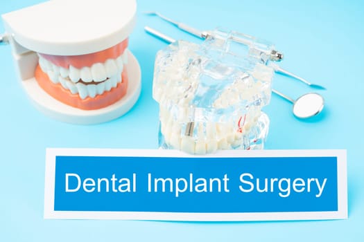 Teeth model and dental tools on blue background, Dental implant surgery concepts