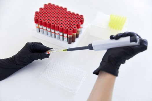 hands of a lab technician with a tube of blood sample and rack with other samples. lab technician holding blood tube sample for study