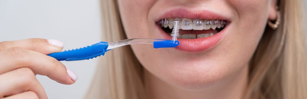 Caucasian woman cleaning her teeth with braces using a brush. Widescreen