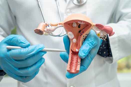 Uterus, doctor holding anatomy model for study diagnosis and treatment in hospital.