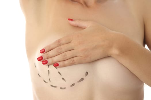 Woman breasts are marked for cosmetic surgery. Enlargement and lift of female mammary glands concept