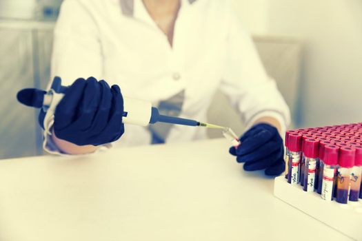 hands of a lab technician with a tube of blood sample and rack with other samples. lab technician holding blood tube sample for study