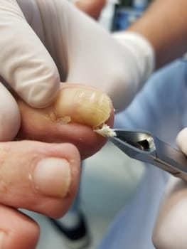 tooth,nail,dentistry,food,hand,dentist,finger,joint,medical,patient,service,skin