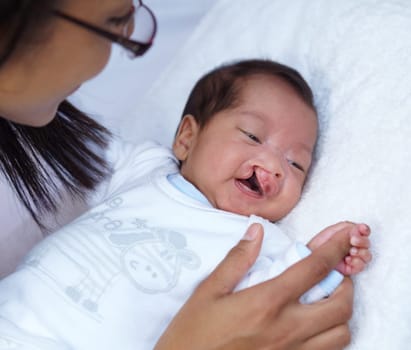 Newborn, cleft palate and parent care for a baby happy in a home bed with a smile in a bedroom or medical centre. Health, healthcare and young child or kid bonding with mother with love and comfort.