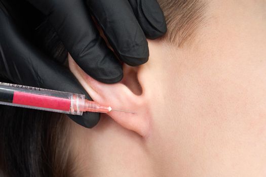 Beautiful woman gets an injection in lips
