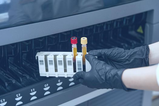 Female Research Scientist Putting Test Tube with Blood Sample into Analyzer Medical Machine. Scientist Works with Modern Medical Equipment in Pharmaceutical Laboratory