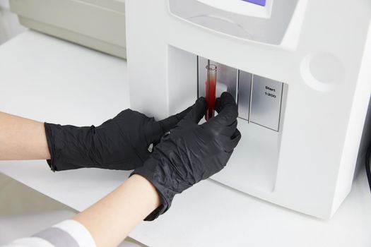 Female Research Scientist Putting Test Tube with Blood Sample into Analyzer Medical Machine. Scientist Works with Modern Medical Equipment in Pharmaceutical Laboratory