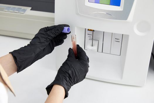 Female Research Scientist Putting Test Tube with Blood Sample into Analyzer Medical Machine. Scientist Works with Modern Medical Equipment in Pharmaceutical Laboratory
