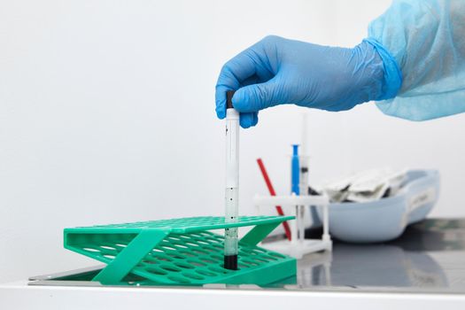 Scientist working with blood sample in laboratory. High quality photo
