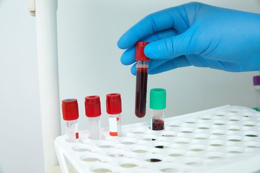 Scientist working with blood sample in laboratory. High quality photo
