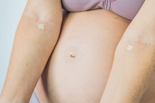 Adhesive bandage on arm after blood test from pregnant woman in gynecological clinic. Prenatal testing. Medical Equipment, Adhesive bandage on a female brachium in medical clinic. Close up, Top view.