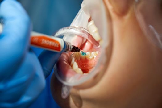 Dentist doing a dental treatment on a patient in medical clinic