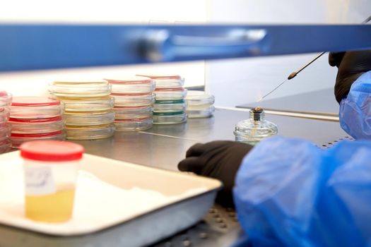 medical technologist doing urine test in medical laboratory wearing protective uniform. High quality photo