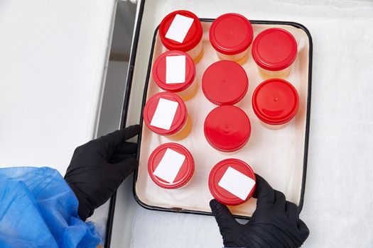Urine analysis in laboratory. Preparation of urine samples in the hospital for the study