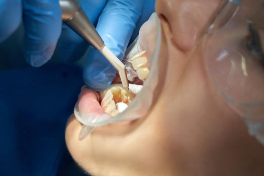 Dentist using air water spray during patient treatment in clinic
